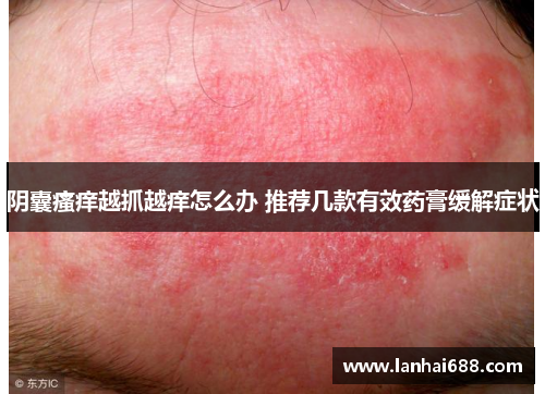 阴囊瘙痒越抓越痒怎么办 推荐几款有效药膏缓解症状