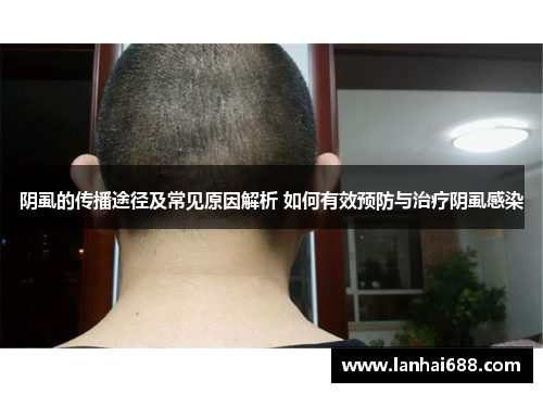 阴虱的传播途径及常见原因解析 如何有效预防与治疗阴虱感染